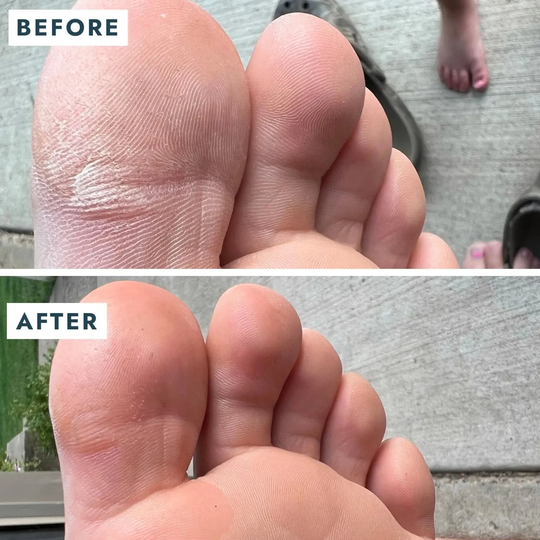 Clearance SoleMate Heel Repair Balm Vegan Pflege|Fußpflege