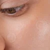 Hot Spot the F Off Invisible Blemish Patches Pickelpflaster|Gesichtsmasken