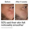 Clearance Starter Retinol Serum Vegan Pflege|Problemlösende Seren
