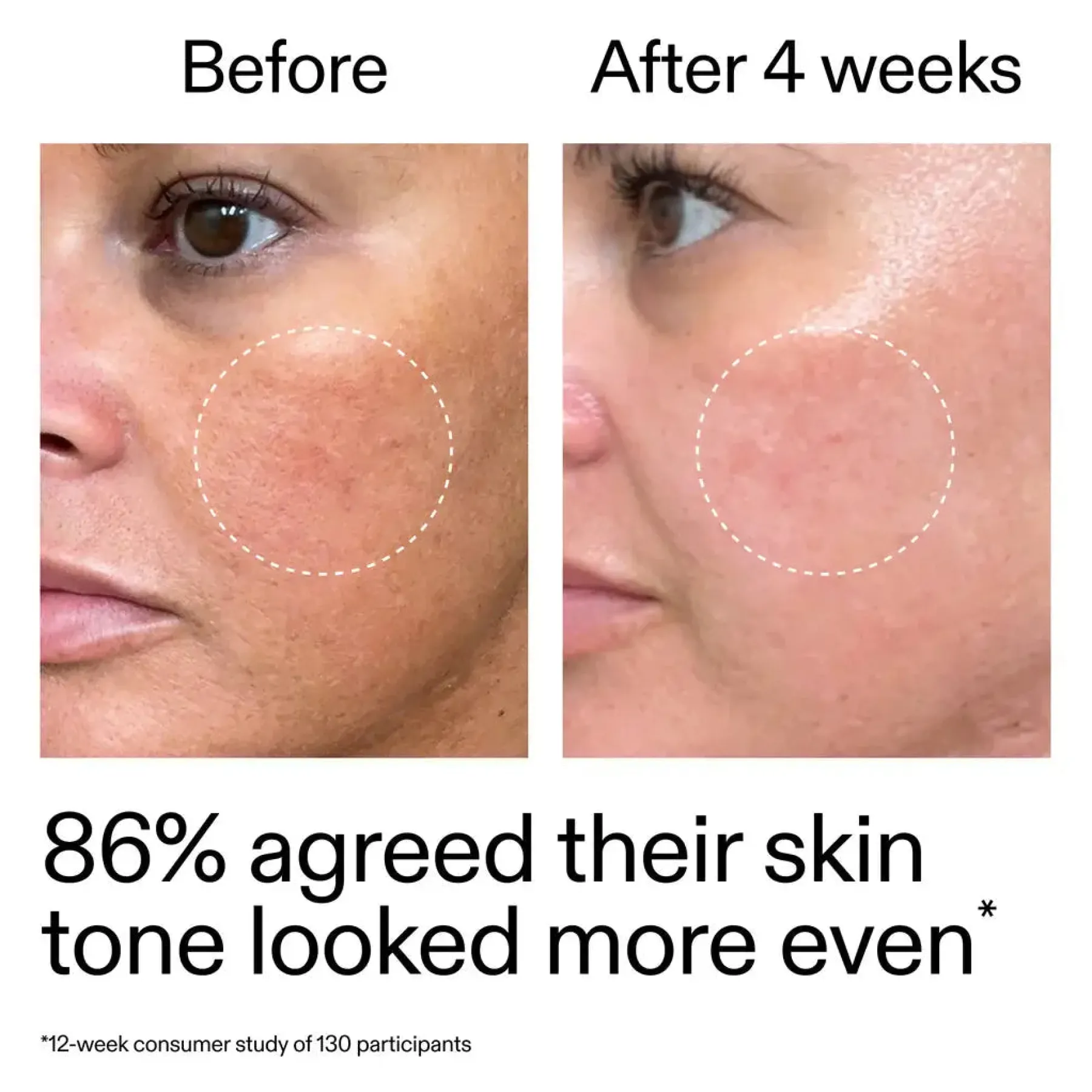Clearance Starter Retinol Serum Vegan Pflege|Problemlösende Seren