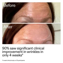 Clearance Starter Retinol Serum Vegan Pflege|Problemlösende Seren