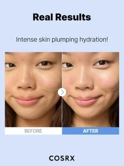 The Hyaluronic Acid 3 Serum Hauptzutat|Feuchtigkeitsspendendes Serum