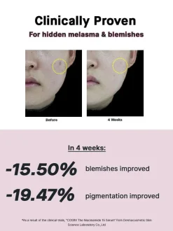 Sale The Niacinamide 15 Serum Hauptzutat|Anti-Unreinheiten-Serum