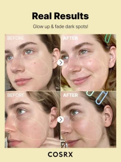 Best The Vitamin C 23 Serum Hauptzutat|Anti-Unreinheiten-Serum