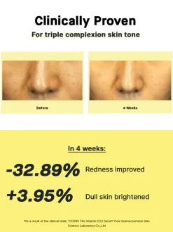Best The Vitamin C 23 Serum Hauptzutat|Anti-Unreinheiten-Serum