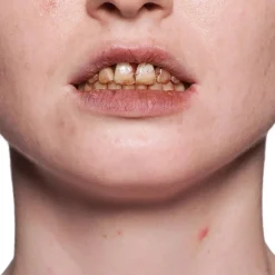 Clearance Tooth Enamel Red Spezialeffekte Make-Up