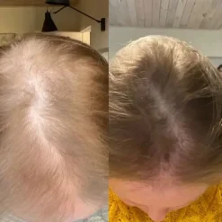 Sale Tripeptide Collagen Kollagen|Hauptzutat