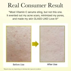 New Vitamin C Booster Shot Mini Anti-Unreinheiten-Serum|Vegan Pflege