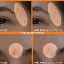 Discount Vitamin C Green Tea Enzyme Brightening Serum Hauptzutat|Anti-Unreinheiten-Serum