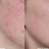 Outlet Vitamine C Serum Vegan Pflege|Problemlösende Seren