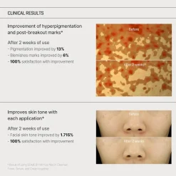 Sale Yuja Niacin Anti-Blemish Cream Feuchtigkeitscremes|Hauptzutat