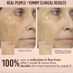 Sale Yummy Skin 10/10 Barrier Boost Vegan Pflege|Problemlösende Seren