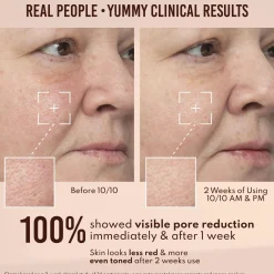 Sale Yummy Skin 10/10 Barrier Boost Vegan Pflege|Problemlösende Seren