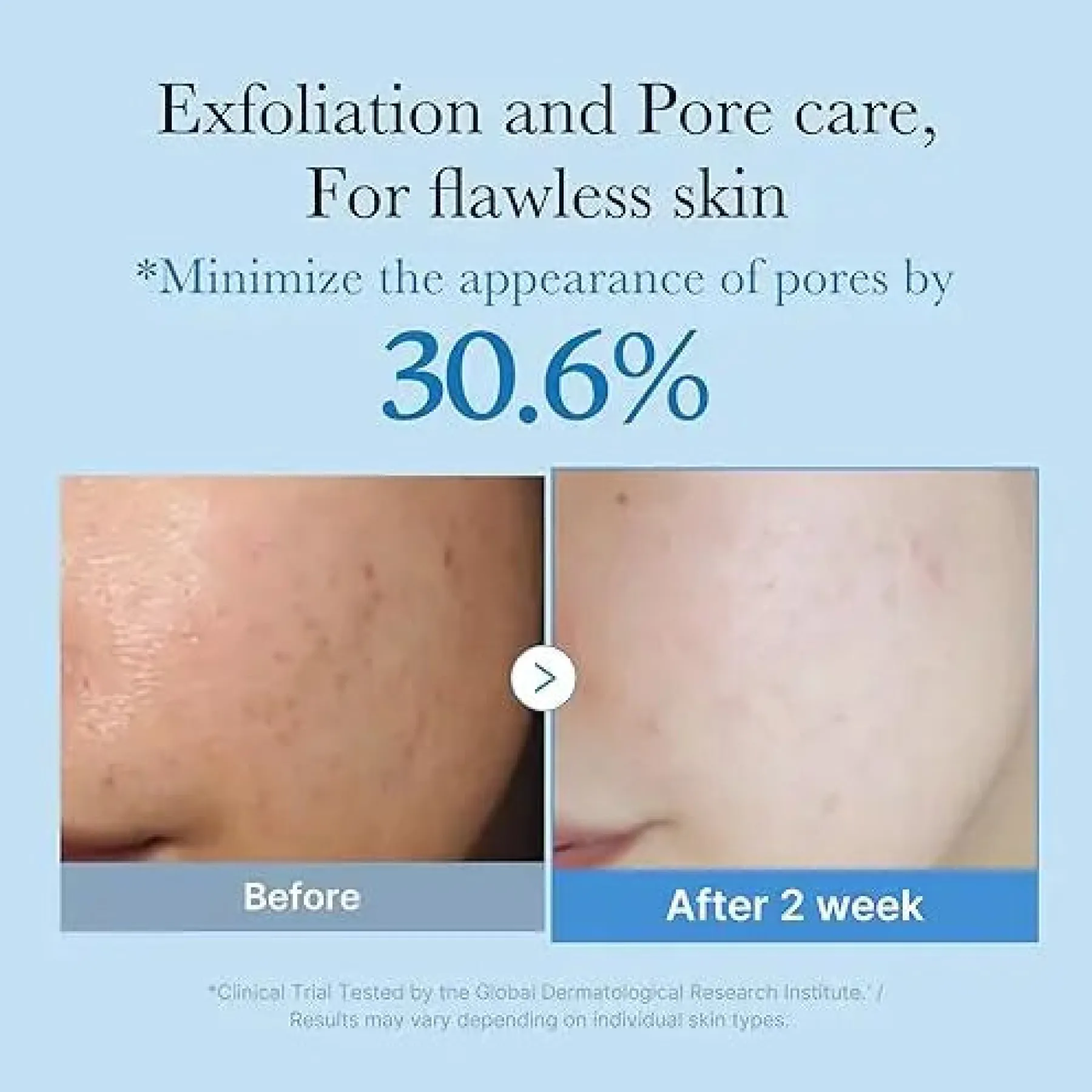 Sale Zero Pore Toner Vegan Pflege|Toners